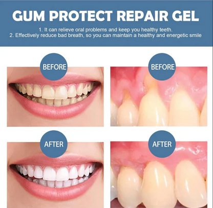 Brinliva™ Teeth Repair Gel